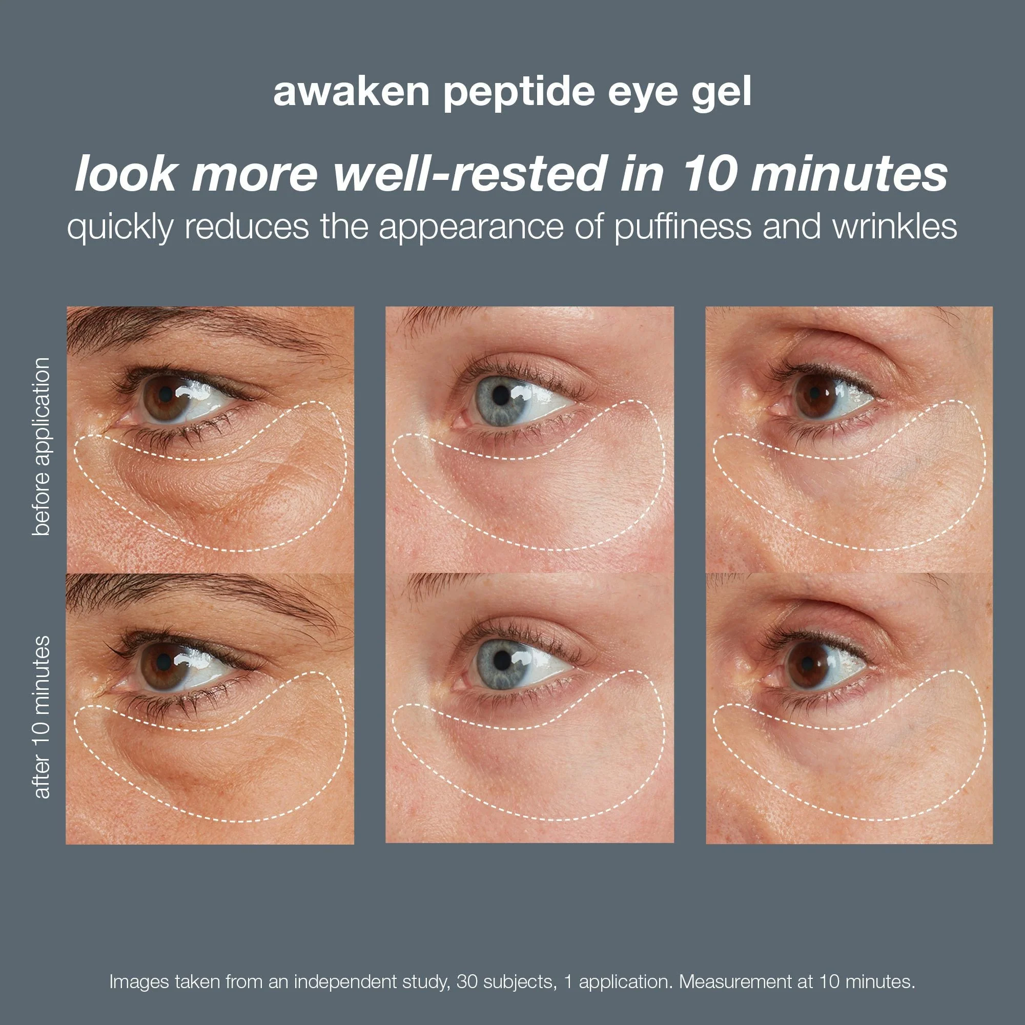 awaken peptide depuffing eye gel - Image 6