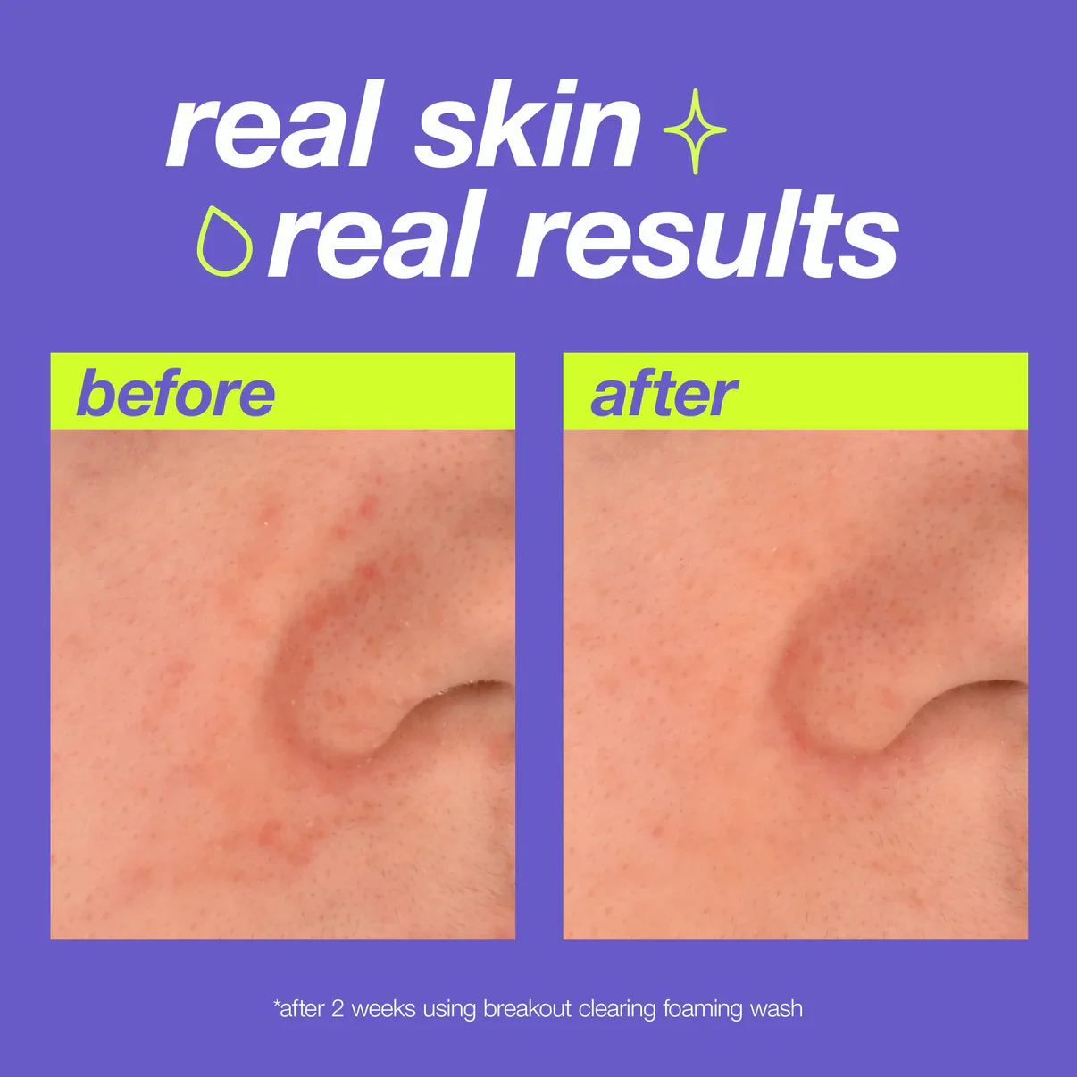 breakout clearing foaming wash - Image 5