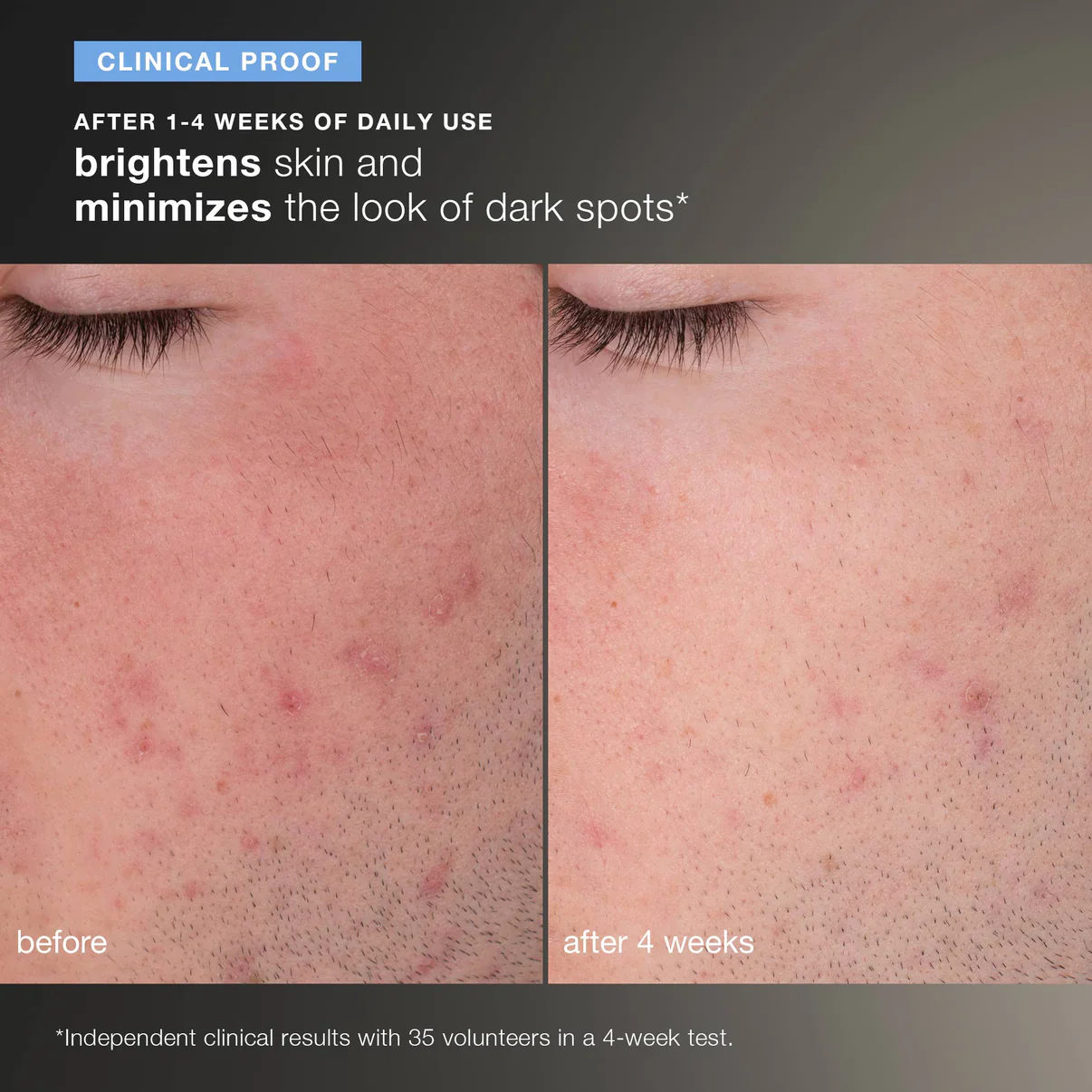 daily microfoliant exfoliator travel size - Image 7