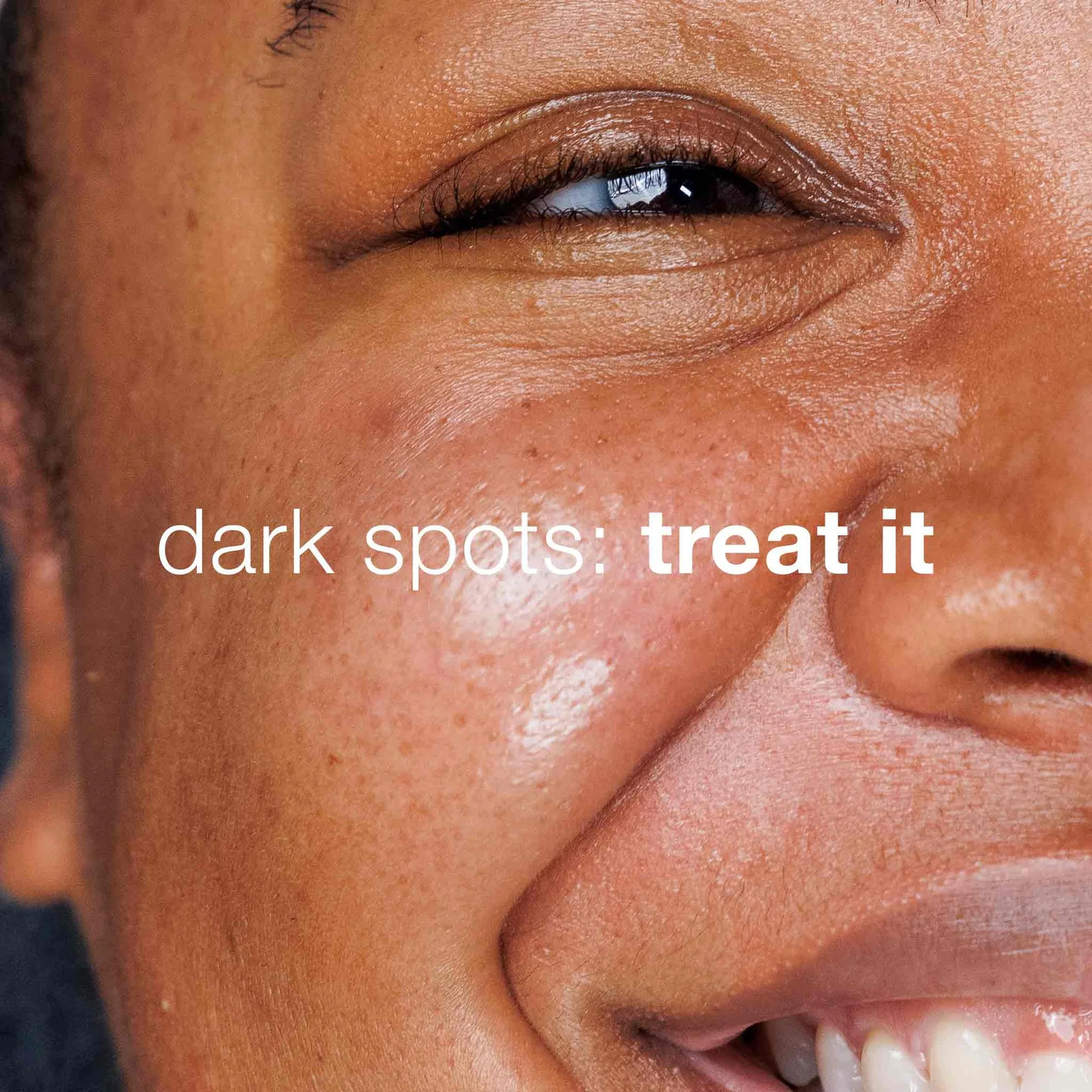 dark spot solutions kit - Image 5