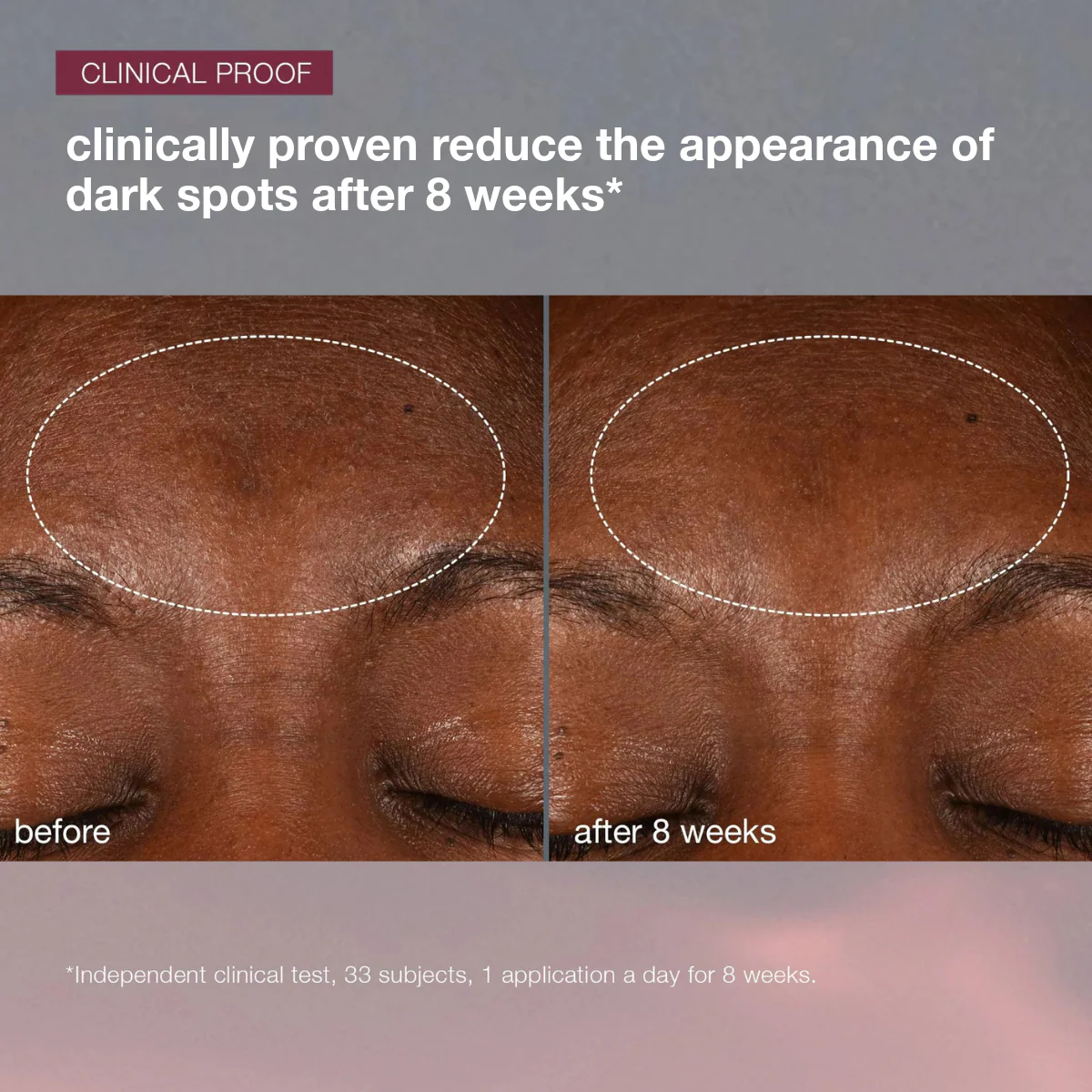dynamic skin recovery spf 50 moisturizer - Image 6