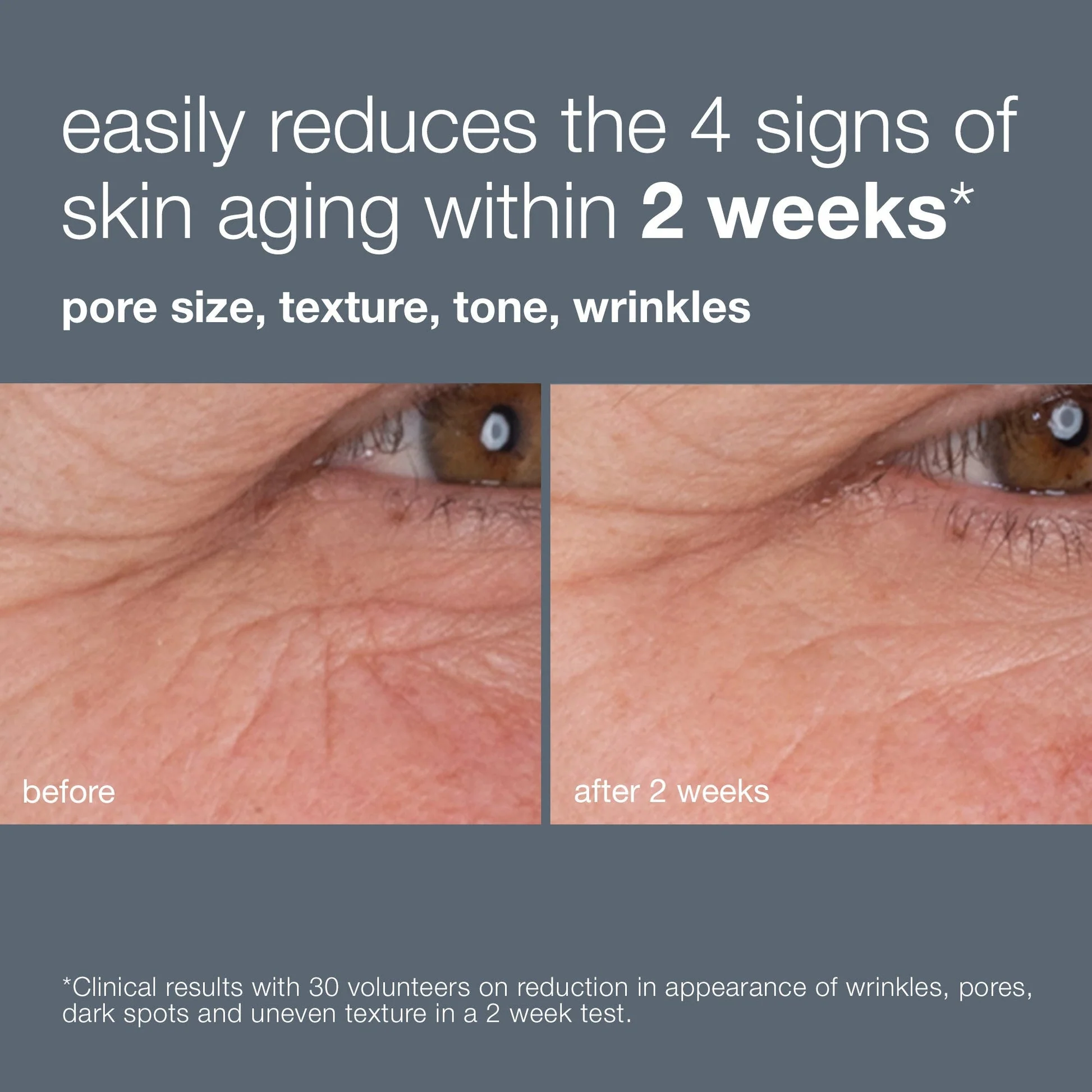 dynamic skin retinol serum travel size - Image 4