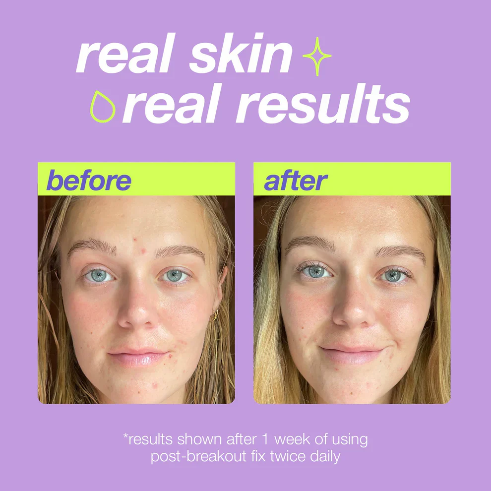 post-spot fix - Image 4
