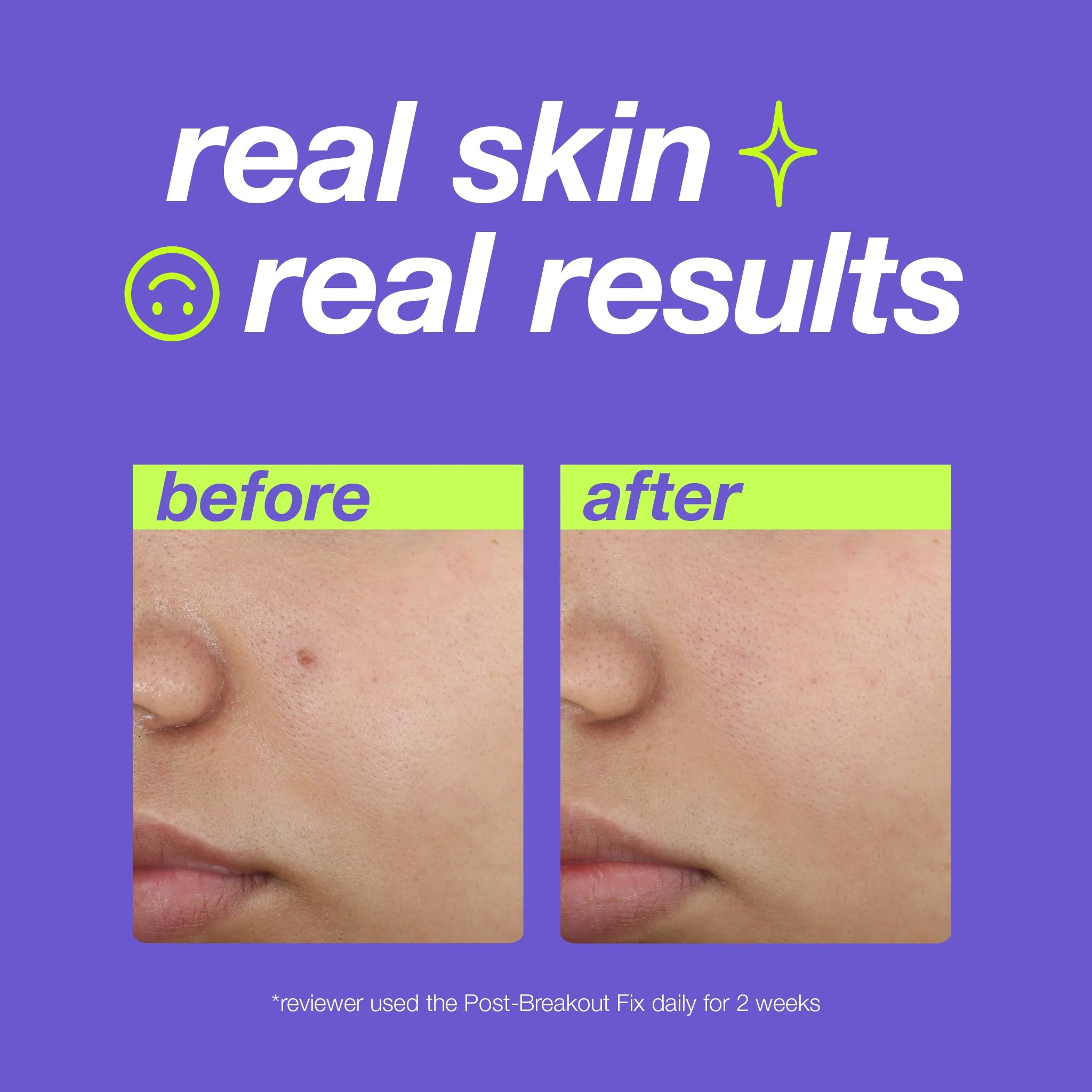 post-spot fix - Image 5