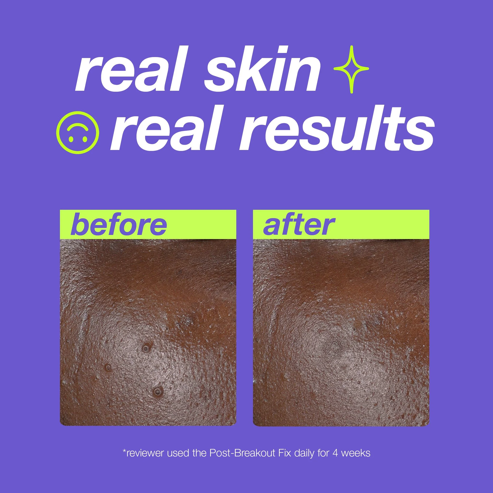 post-spot fix - Image 7