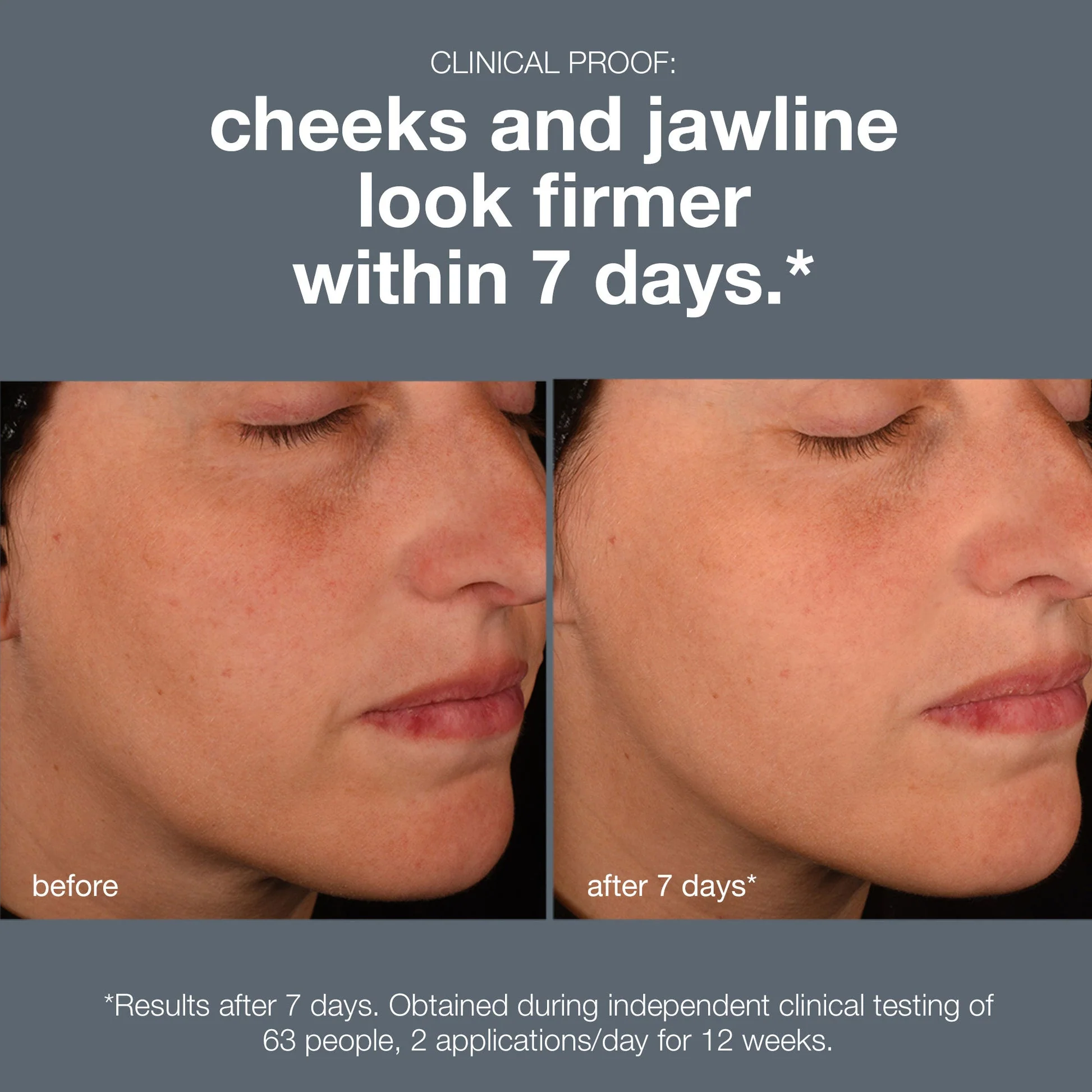 pro-collagen banking duo - Image 4