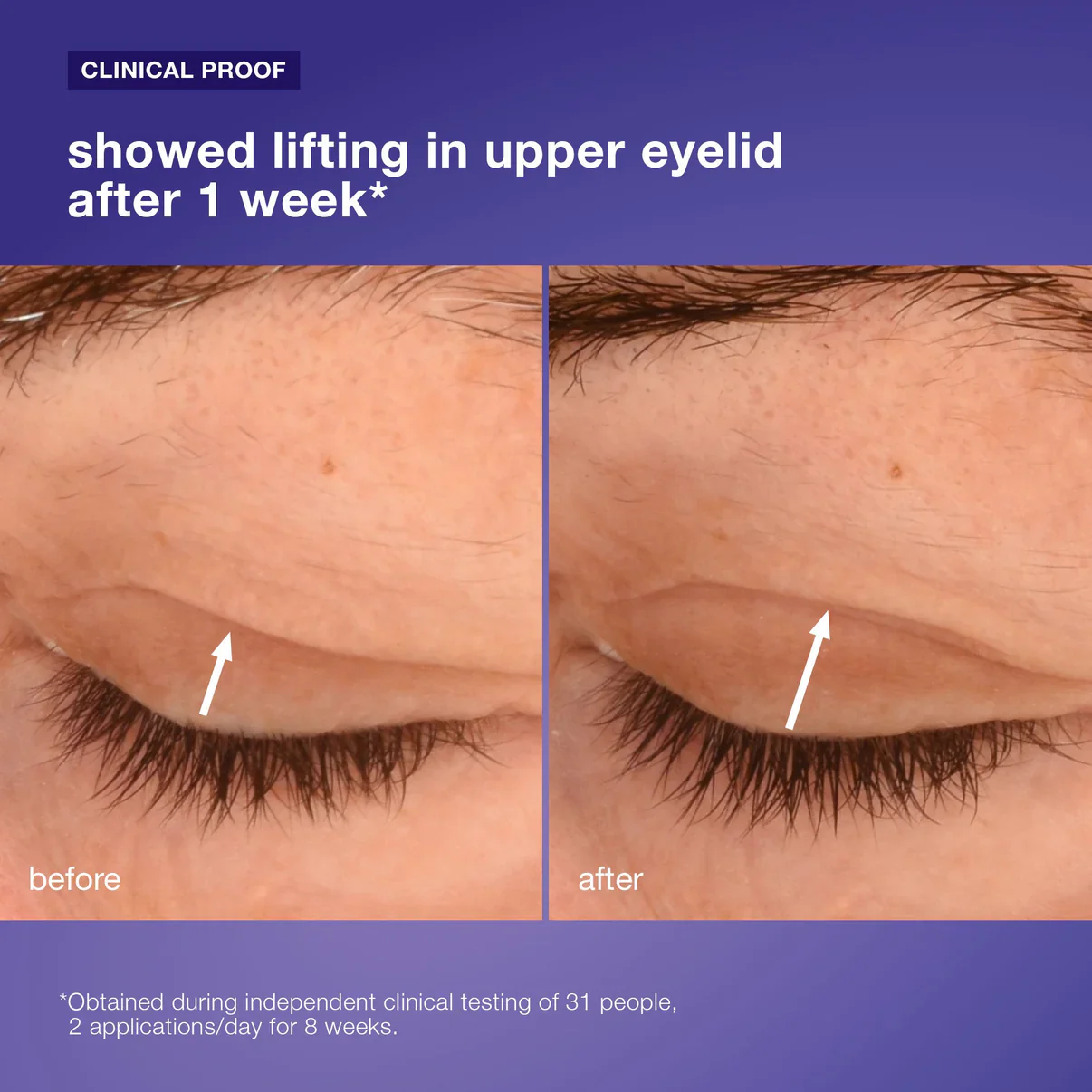 phyto nature lifting eye cream - Image 6