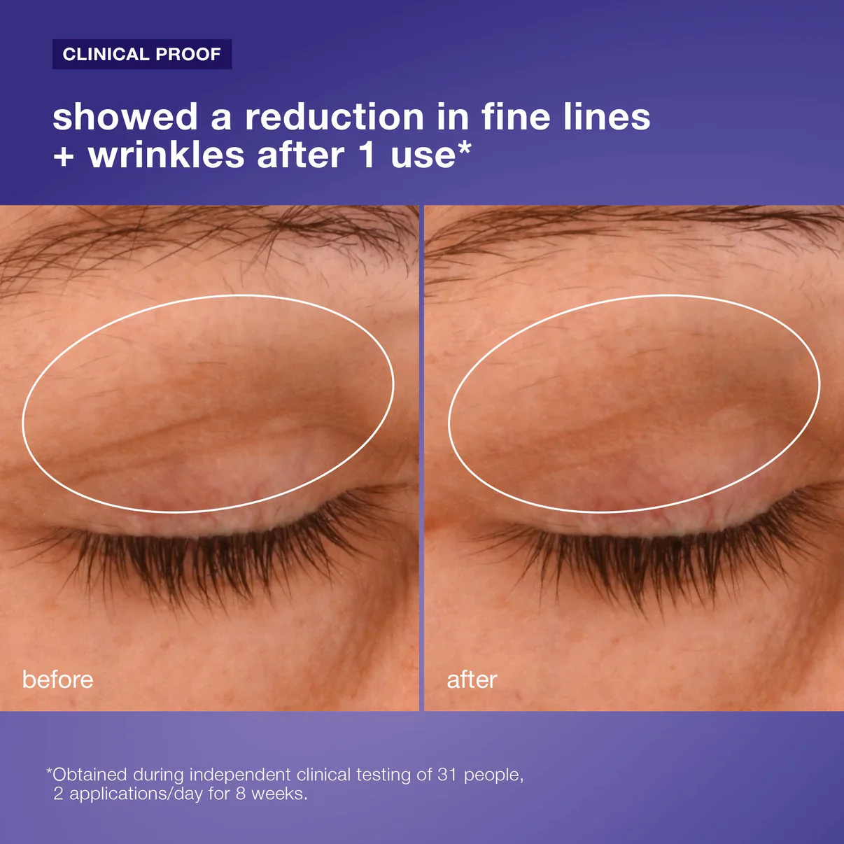 phyto nature lifting eye cream - Image 5